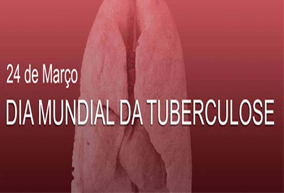 <!--:pt-->Diretor da FCS/UFGD, professor Julio Croda fala do Dia Mundial da Tuberculose  <!--:--><!--:en-->Diretor da FCS/UFGD, professor Julio Croda