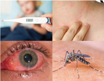 Vamos falar sobre o Zika? Veja algumas perguntas e respostas sobre o vírus