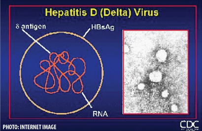 Newsletter  79 – Hepatite Delta: O vírus dos pobres