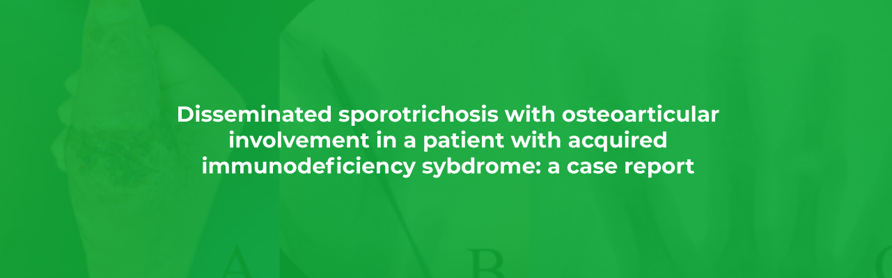 Disseminated sporotrichosis with osteoarticular involvement in a patient with acquired immunodeficiency syndrome: a case report