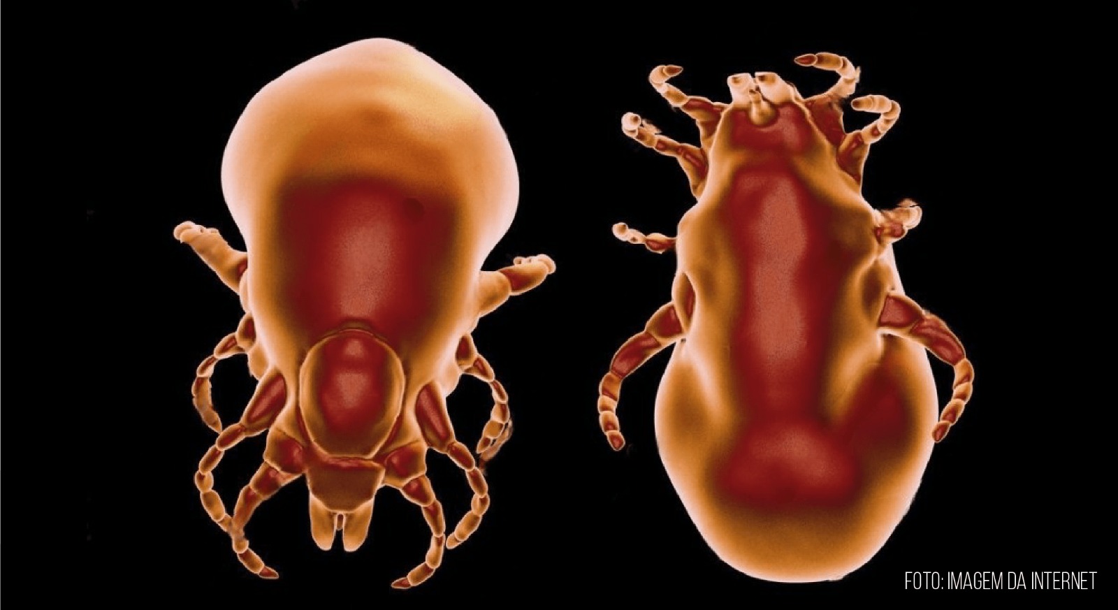 Doença de Lyme e Síndrome de Baggio-Yoshinari: controvérsias desafiam diagnósticos no Brasil