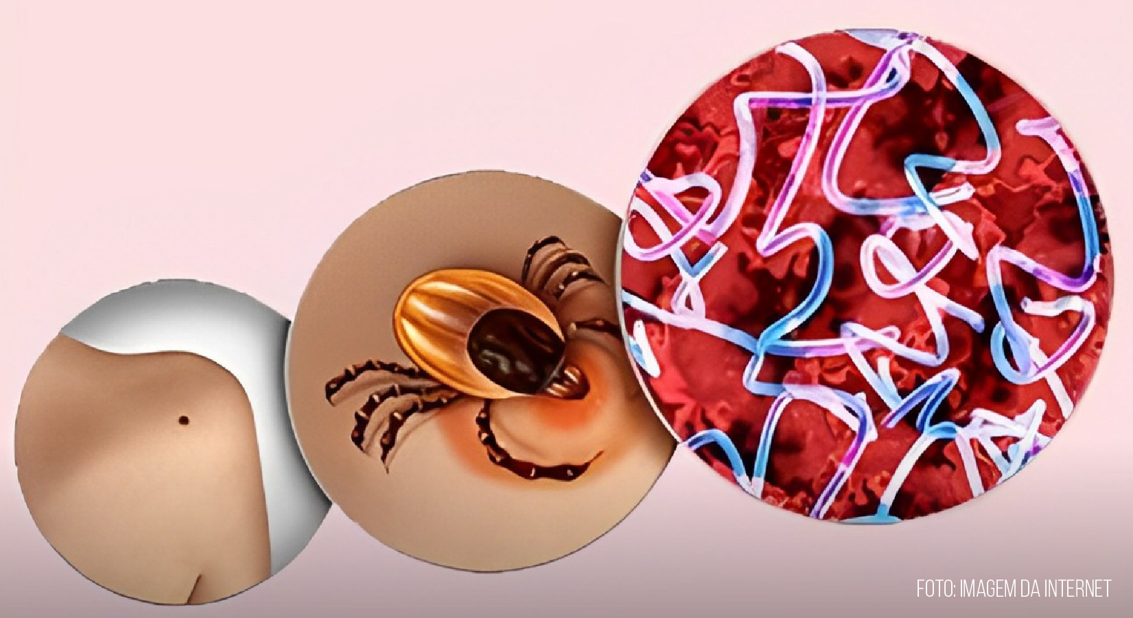 Artigo científico revela importância de métodos moleculares para diagnóstico de doença por Rickettsia