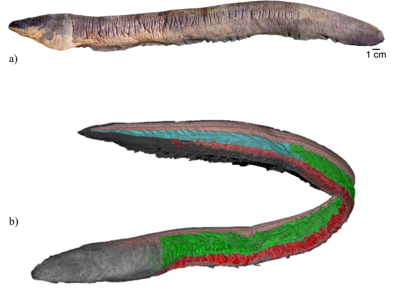 Two Clinical Records of Human Injuries with a Death caused by Electric Eels Electrophorus spp