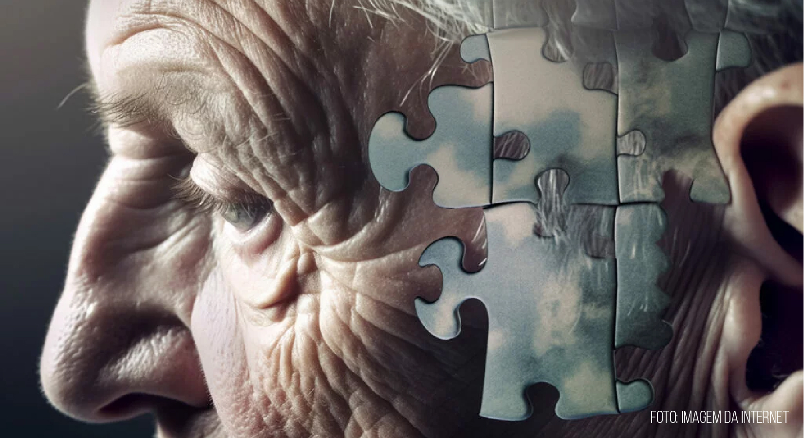 Vacina contra herpes-zóster pode oferecer proteção contra demência e Alzheimer, segundo novo estudo