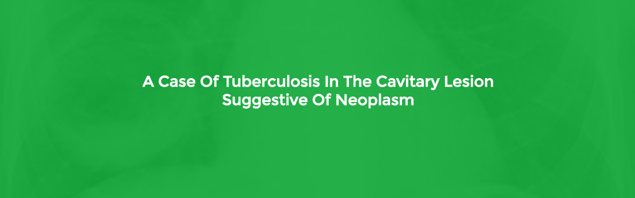 A Case Of Tuberculosis In The Cavitary Lesion Suggestive Of Neoplasm