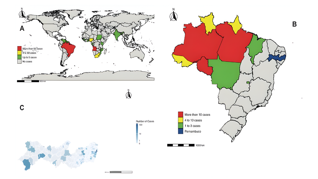 Importação contínua de malária mantém Pernambuco em alerta e expõe fragilidades no acesso ao diagnóstico