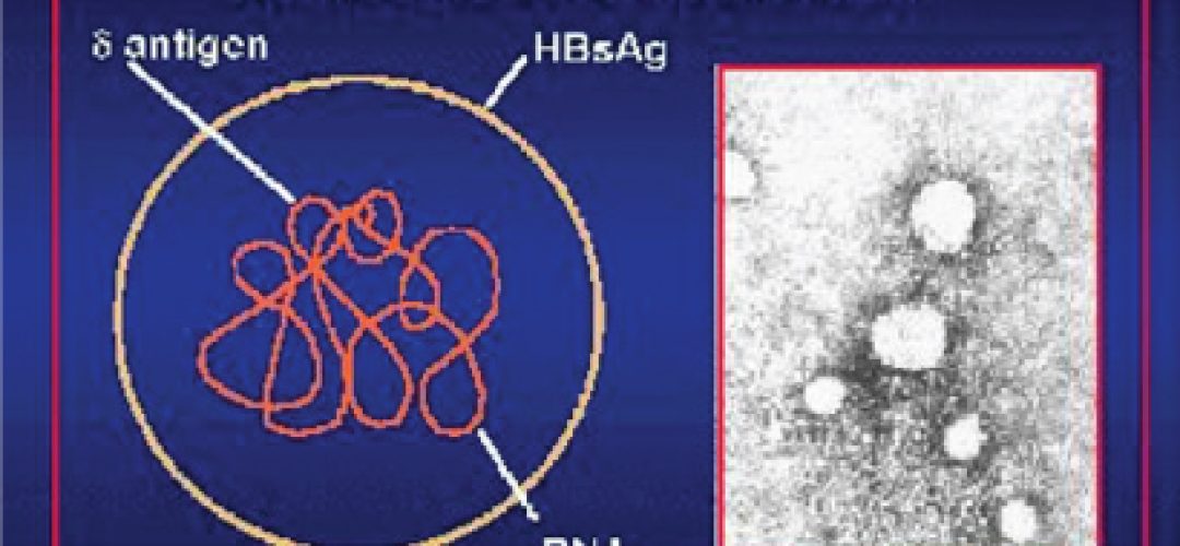 O vírus da Hepatite D atua como um parasita e precisa se ligar ao vírus da Hepatite B para que ocorra a infecção
