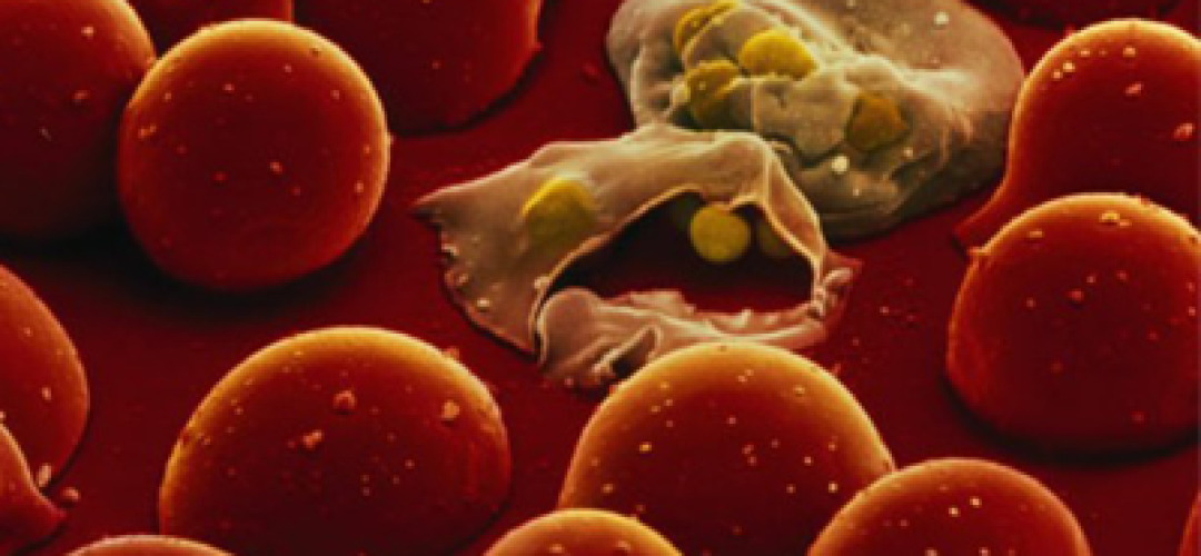 The urge to eliminate P. falciparum is also due to the imminent risk of the parasite developing resistance to the drugs currently used in the world