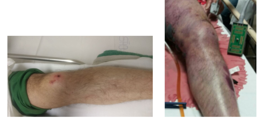 f65984847