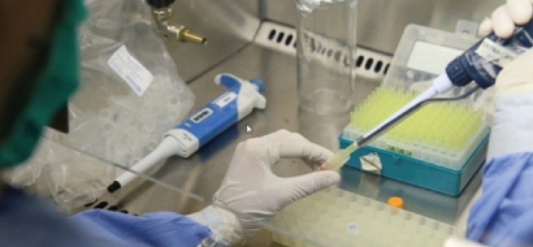 Social investments in sectors that support public health, as basic sanitation, which covers a small portion of the Brazilian population, should also be affected