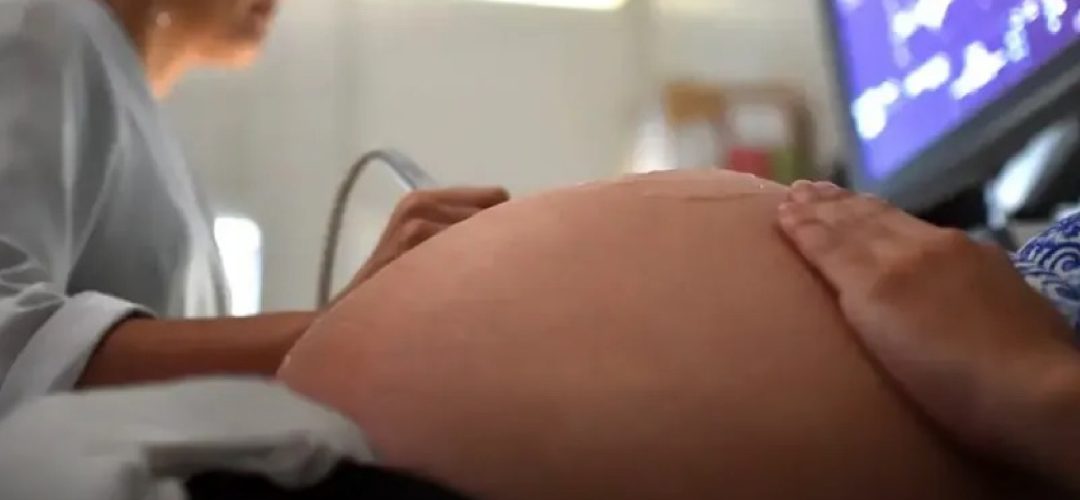 Médicos e profissionais de saúde estão sendo orientados a ficarem atentos aos sintomas da doença em gestantes e a reportarem imediatamente qualquer caso suspeito