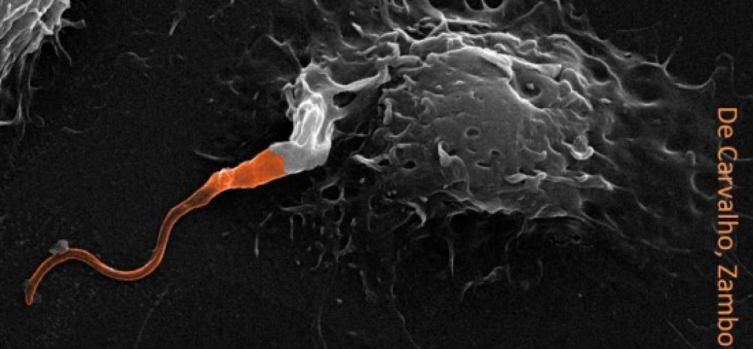 In orange we see leishmania infecting a macrophage, one of the first defense cells to come into action during an infection