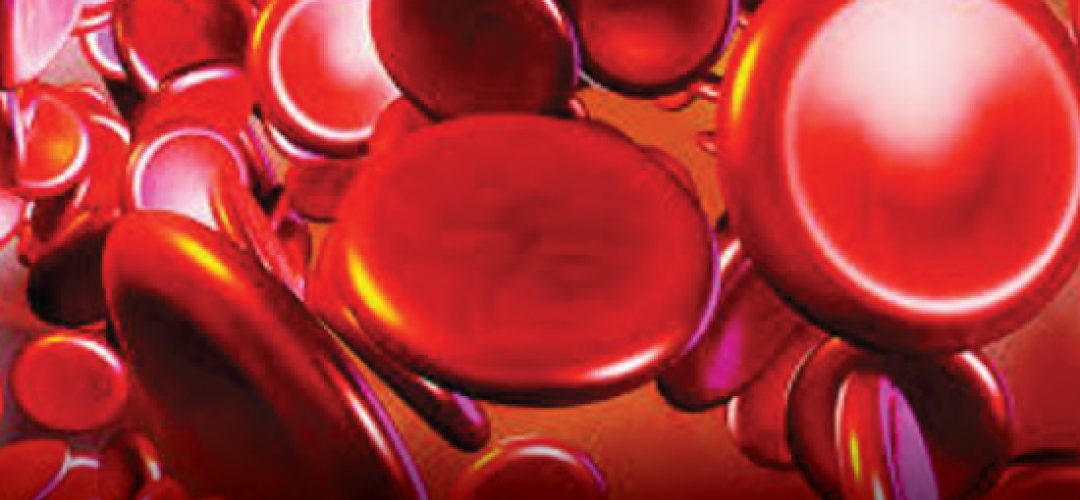 ICNARC reported that 1 in 5 severely ill coronavirus patients requires renal replacement therapy for an average of 4 days