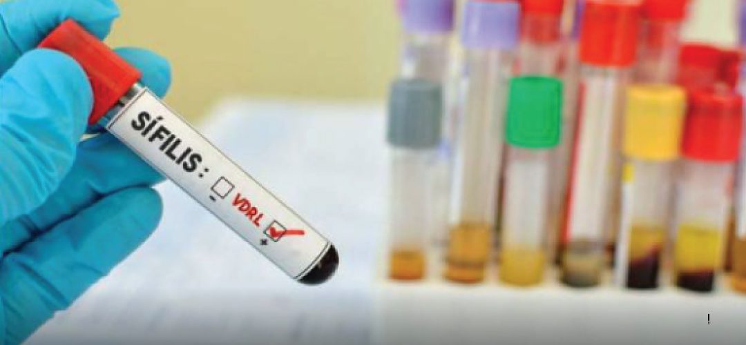 There has been an unexpected increase in acquired syphilis cases in Brazil, but cases of congenital syphilis are the of greatest concern