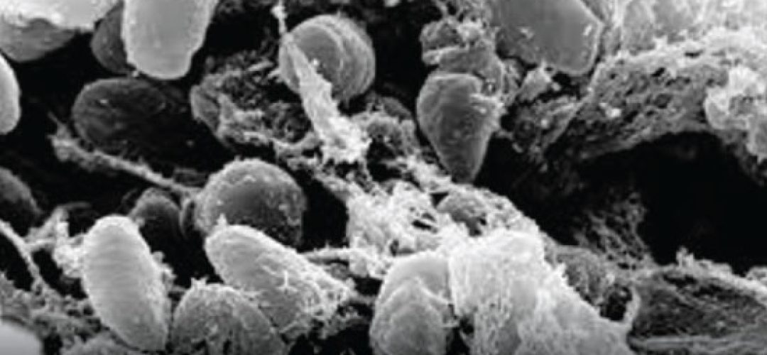 The development of antibiotics has reduced the plague mortality rate, but the disease is still a fast spreading public health problem