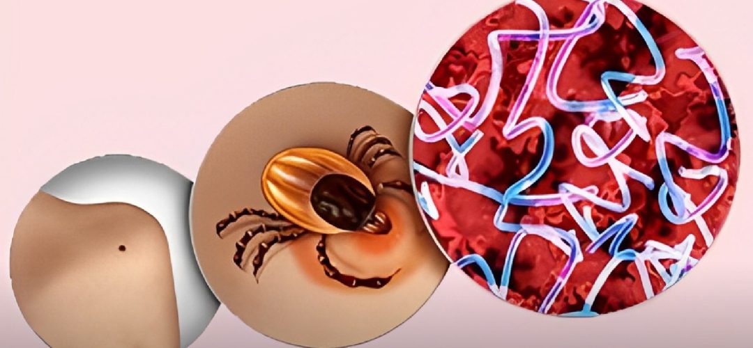 Técnicas como a PCR e suas variações superam os métodos tradicionais ao oferecer maior precisão e sensibilidade na detecção do DNA bacteriano, possibilitando diagnósticos rápidos e eficazes