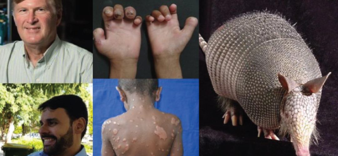 Our study calls attention to the possibility of leprosy zoonotic transmission