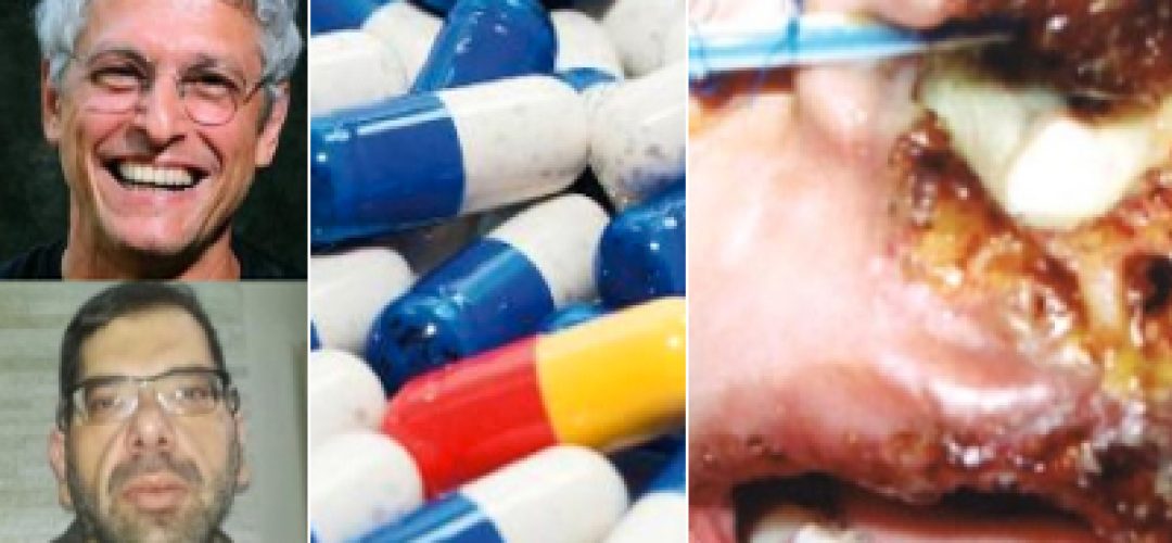 Principal vantagem da anfotericina B lipossomal é a sua baixa toxicidade, tempo de tratamento reduzido e possibilidade de utilização em pacientes com contra indicação, intolerância ou má resposta a outros medicamentos